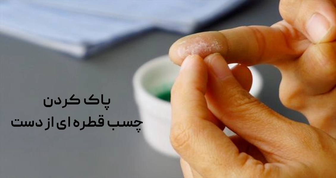 چسب قطره ای از دست