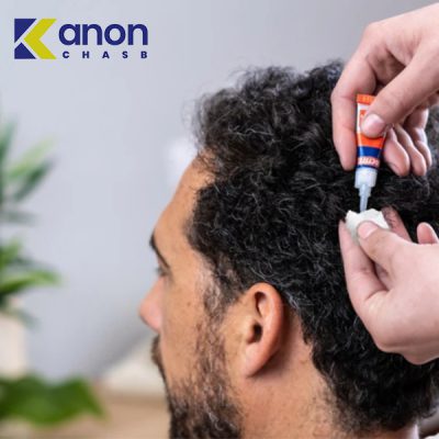 پاک کردن چسب قطره ای از مو