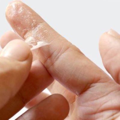 پاک کردن چسب قطره ای از دست