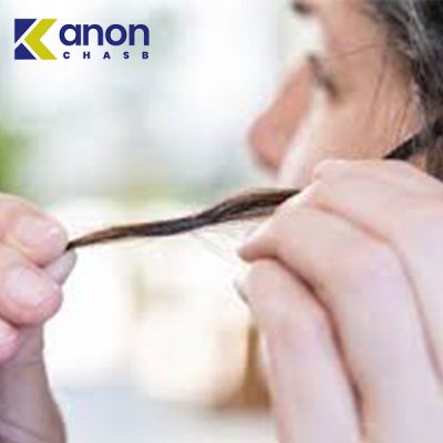 پاک کردن چسب قطره ای از مو