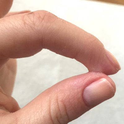 پاک کردن چسب قطره ای از دست